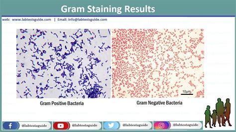gram stain results table|Gram Stain: Reference Range, Interpretation, Collection .